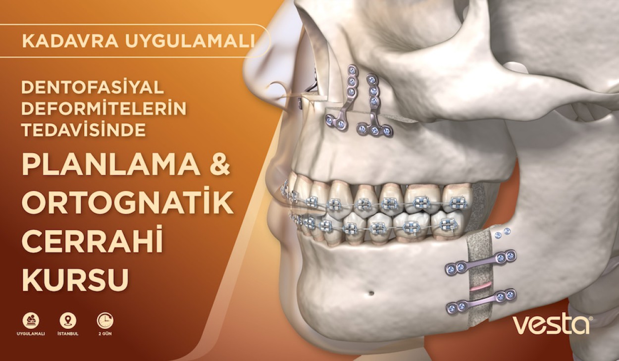 Dentofasiyal Deformitelerin Tedavisinde Planlama ve Ortognatik Cerrahi Kursu